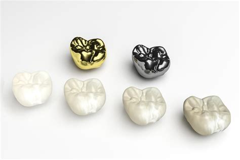 prefabricated porcelain ceramic crowns